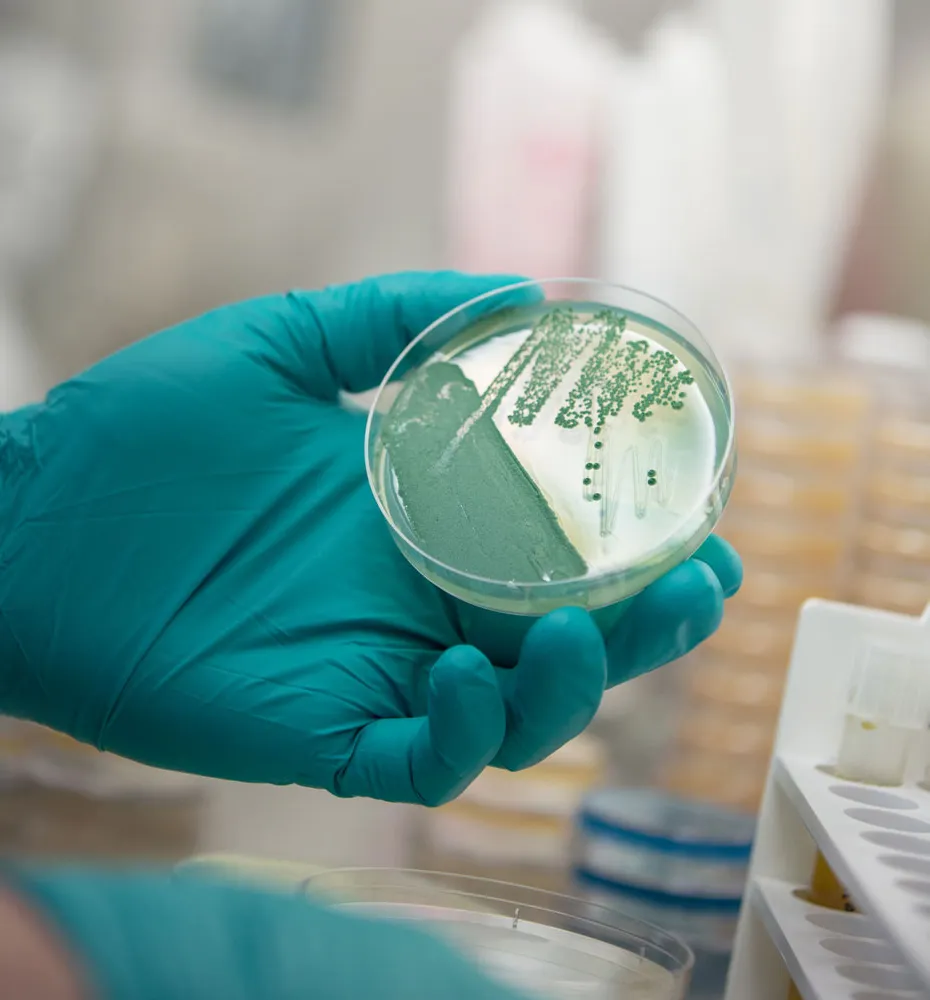 Vaccination' title='Qu’est-ce qui donne un goût aigre à une bière aigre ?