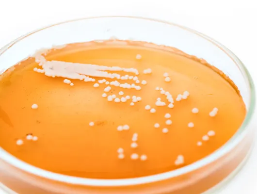 élesztő' title='Yeast Egy romantikus történet